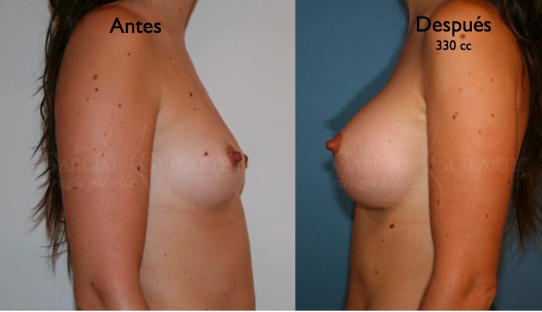 Las kazajas el pequeño pecho